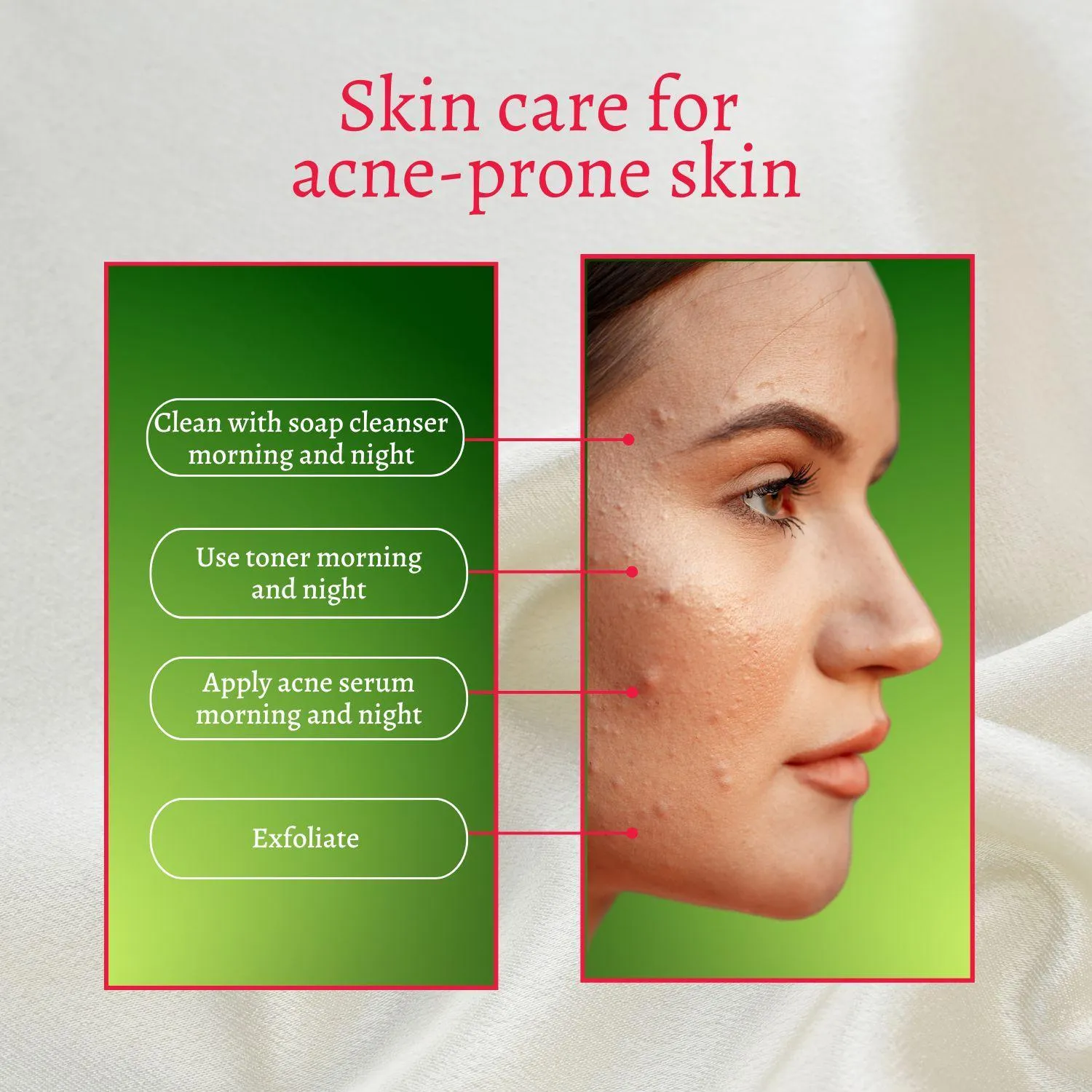 Acne Set: Cleanser, Toner, Serum, and Acid Peel