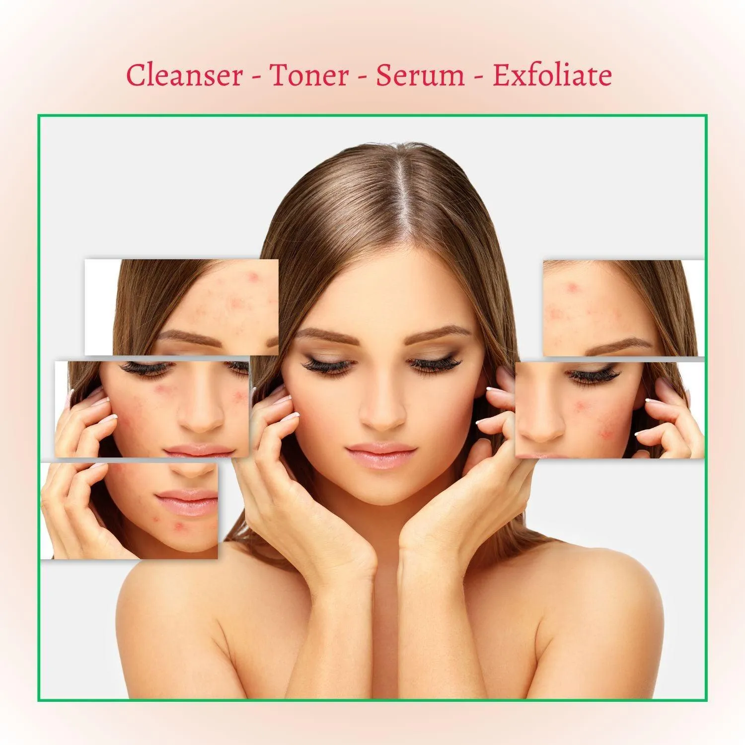 Acne Set: Cleanser, Toner, Serum, and Acid Peel